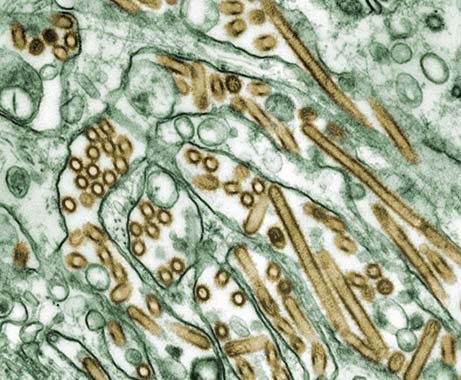 Elektronenmikroskopische Aufnahme von H5N1 (Virus ist digital golden nachgefärbt)(Photo Credit: Cynthia Goldsmith Content Providers: CDC/ Courtesy of Cynthia Goldsmith; Jacqueline Katz; Sherif R. Zaki/Wikimedia)